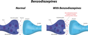 Example of the Cause of Addiction through Benzodiazepines | Increased Tolerance | Find Addiction Rehabs | Demonstration of benzodiazepine tolerance