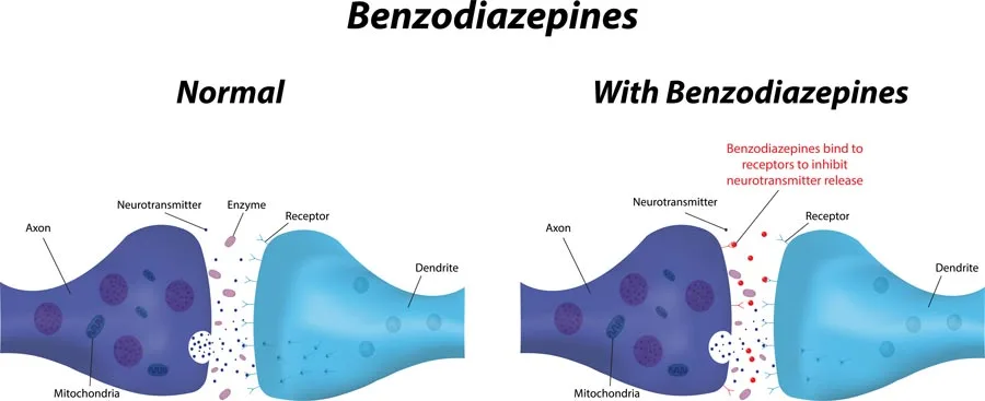 Side Effects of Benzodiazepine Abuse