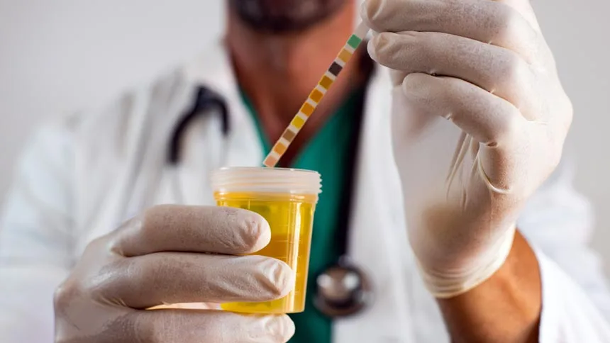 Detect Percocet On Urine Tests