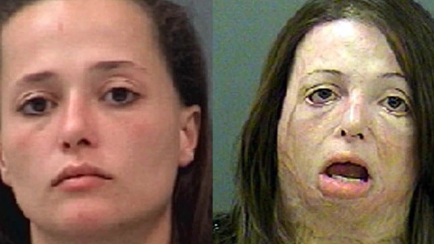 Before and after Meth users