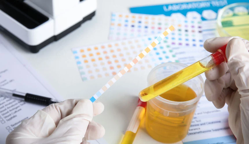 Urine Drug Test